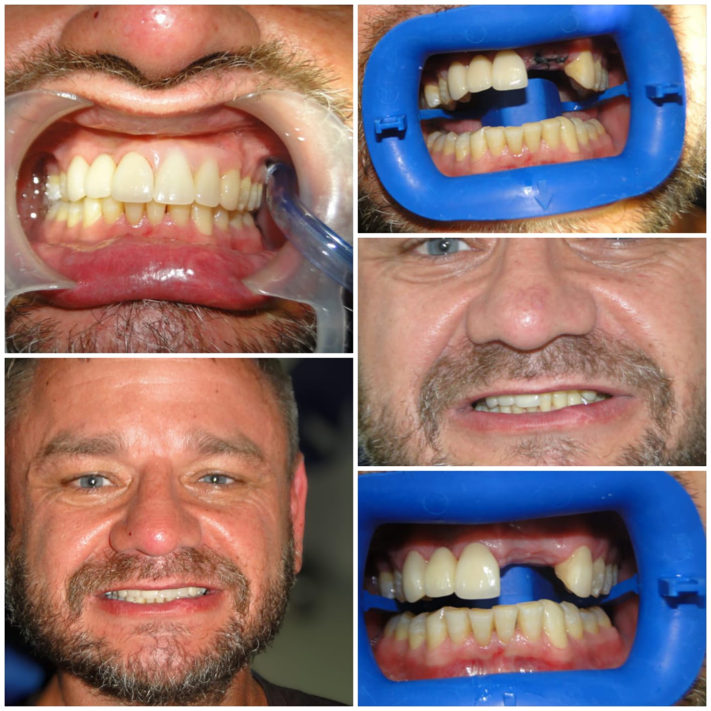 Emergency Department